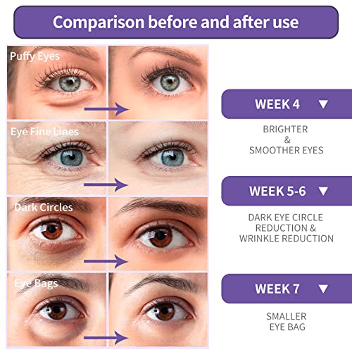קרם עיניים של Breelee רטינול - עיניים נפוחות וטיפולים במעגלים כהים - נראה צעיר יותר ומפחית קמטים וקווים