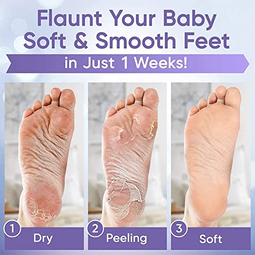 פילינג רגליים פילינג מסכת עבור יבש סדוק עקבים-2 + 1 חבילות-להפוך שלך רגליים תינוק רך לקבל חלק משיי עור, יבלות