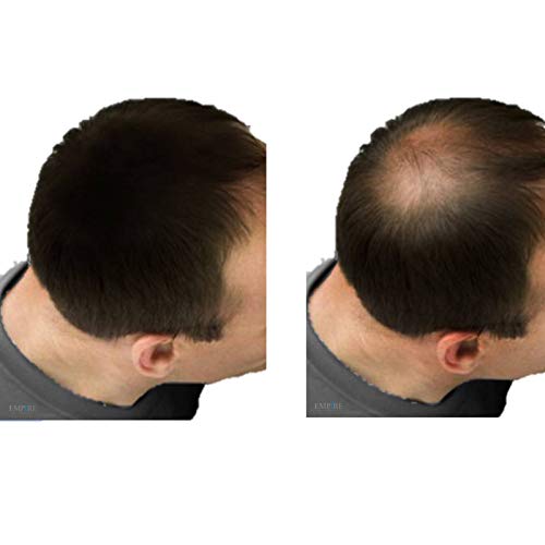 אימפריה שיער מקס קרטין אובדן קונסילר עיבוי סיבי בונה 0.88 עוז / 25 גרם