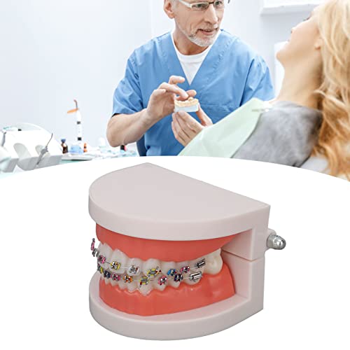 שיניים דגם, שיניים שיניים מודלים ילדים שיניים הוראת אספקת מחקר עם אורתודונטי מתכת סוגר שיניים אורתודונטי טיפול