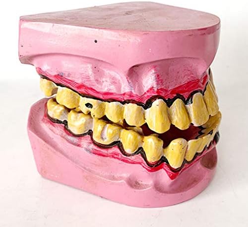 Lemita מעשנים אנושיים שיניים פתולוגיות מודל דרך הפה - חינוך מודל שיניים - הפגנת מחלות שיניים מחקר לימוד שיניים