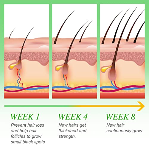 אורז מים לצמיחת שיער, שיער צמיחת שמן, אורז מים שיער צמיחה טיפול עבור חזק עבה יותר שיער לצמיחה